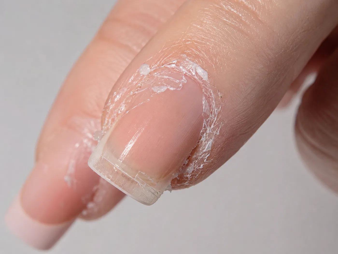 Nail Glue on Skin